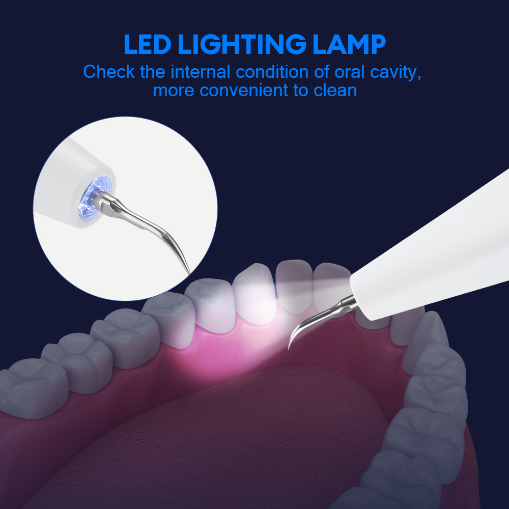 อัลตราโซนิกทันตกรรมแคลคูลัสRem - Teeth Whitening Strips บทวิจารณ์และราคา
