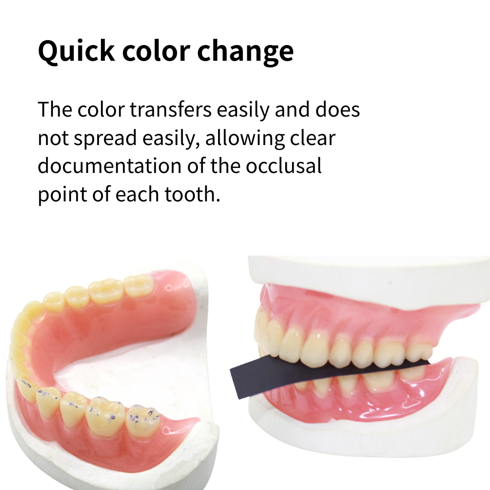 กระดาษอุดฟัน AG 300 ชิ้น สำหรั - Teeth Whitening Strips บทวิจารณ์และราคา